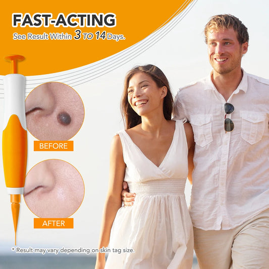 Rubber Rings Skin Tag Removal Tool Face Beauty Accessories Skin Tag Removal Device Multipurpose Supplies for Face Neck Chin Back